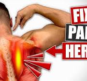 The REAL Fix For Rhomboid Pain [Not What You Think!]