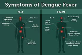 Image result for Dengue