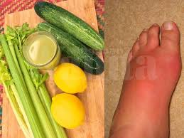 Dengan begitu, kondisi tekanan darah tinggi dapat diatasi dan dicegah menjadi lebih buruk. Resepi Minuman Hijau Untuk Rawat Sakit Gout Cuma Perlukan 3 Bahan Dapur Saja Mingguan Wanita
