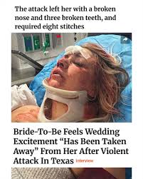 Yeah here in America you get to pay for your own assault