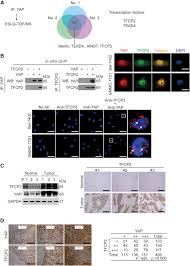 Whether in amsterdam, berlin or zurich, with your visa debit card you are welcome everywhere. Tfcp2 Is Required For Yap Dependent Transcription To Stimulate Liver Malignancy Sciencedirect