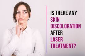 Devices weren't sophisticated enough to distinguish well between the pigment in brown or black skin and dark hair, meaning. Skin Discoloration After Laser Treatment 3 Risks And Solutions