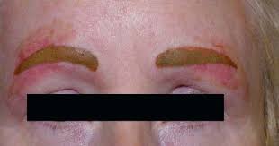 Bad Permanent Makeup Bad Permanent Makeup Example Permanent Makeup Permanent Makeup Training Makeup