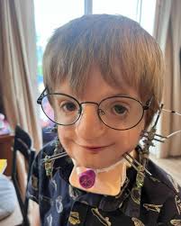 Today, Abigail is here to ask us all an important question: Do you bedazzle  your scars?! When Abi acquired a new scar