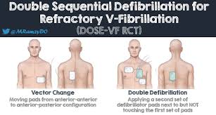 Image result for Ventricular Fibrillation Management in the Adult