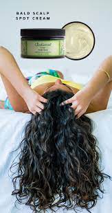 Bald Scalp Spot Cream In 2020 Long Hair Styles Diy Hair Growth Treatment Hair Growth Treatment