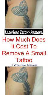 Tattoo Equipment Why Does Skin Itch After Tattoo Laser Removal Laser Tattoo Removal Machines For Sale Affordabl Tattooentfernung Tatowierungen Tattoo Magazin