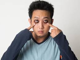 Stimulate eye bags and puffiness. How To Get Rid Of Men S Dark Circles Under Eyes Styles At Life