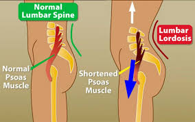 Yoga poses for lumbar lordosis. Psoas So What Finding And Exploring The Psoas In 10 Yoga Poses Laptrinhx News