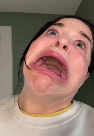 Farewell TikTok: A Big Mouth's Goodbye