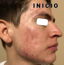 Perfil de Dermatóloga Dra. Sonia Calles