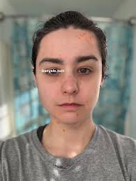 Has anyone noticed improved skin elasticity, especially