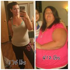 Pin On Gastric Bypass Rny