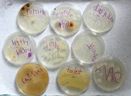 Swab Grow Bacteria Growth Experiment No Time For Flash