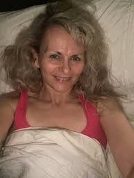 Two weeks in I'm doing ok but still swollen, getting better