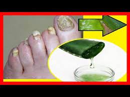 Mentholatum En Los Pies Para Que Sirve Mentholatum