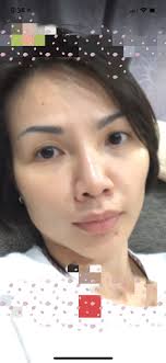 Chantelle Sydney Gold Bio Placenta Sheep Extract 6 x 10ml Pack