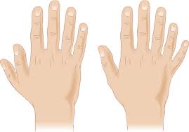 Physioplus team a team of committed. Pallister Killian Mosaic Syndrome Medlineplus Genetics