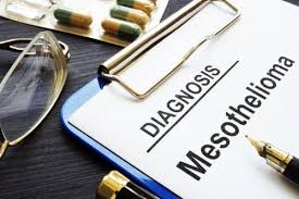 We did not find results for: What Organs Are Affected By Mesothelioma Pintas Mullins Law Firm