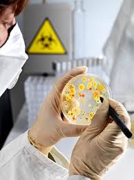 Alzheimer S Causing Amyloid And Bacteria Trigger Uc Davis Health System Feature Story Dog Food Recipes Metal Health Health