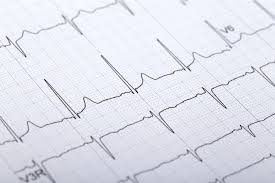 Image result for Electrocardiogram