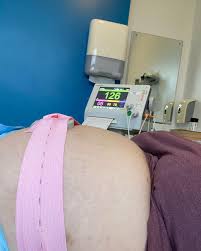 So I'm still in hospital. Doctors...