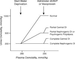 Diabetes Insipidus And Siadh Sciencedirect