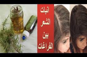 اكليل الجبل معجزة يطول الشعر الى الركب ينبت الشعر حتى لو كنت صلعاء يوقف التساقط الشديد وشيب الشعر youtube voss bottle bottle plastic water bottle