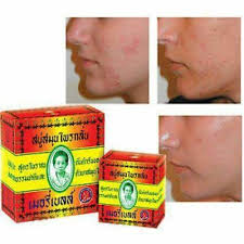 12x MERRY BELL Madame Heng Herbal Soap Original Natural Anti-Acne Face Body  160g