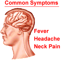 Read about treatment, causes, diagnosis. Neuroscience For Kids Meningococcal Meningitis