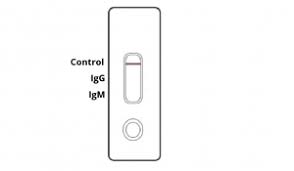 The testing is basically worthless if you don't get a result within a few days. Covid 19 Antibody Rapid Test Kit Coronavirus Igm Igg Antibody Test