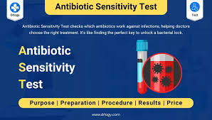 Image result for Test Sensitivity