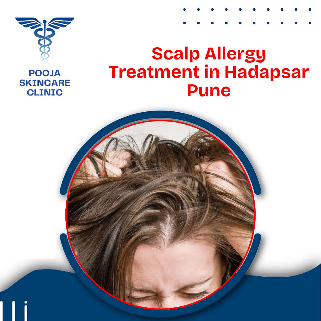 Scalp Allergy Treatment in Hadapsar Pune product image