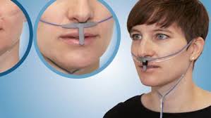 Respiratory-Swallowing Coordination in Motor Neuron Disease: A Scoping  Review