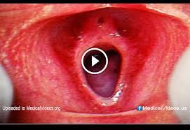 The female reproductive system also facilitates the. Medical Education The Female Reproductive System Doktorz