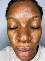 Critique needed for portrait face proportions in oil painting