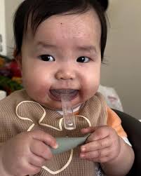 Center for Infant Tethered Oral Ties