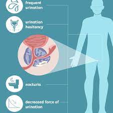 Prostate cancer is common among american men. Prostate Cancer Signs Symptoms And Complications