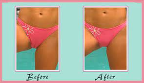 Learn how you can avoid camel toe. Camel Toe No Mo Mythirtyspot