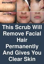 This method is perfect for lightening and removing unwanted facial hair, but it can also be used on other body parts. How To Remove Facial Hair All Products Are Discounted Cheaper Than Retail Price Free Delivery Returns Off 63