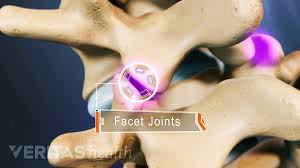 You may be prescribed pain relief . Facet Joint Disorders And Back Pain