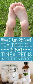 Pin On Natural Remedies