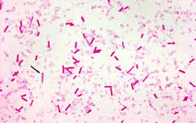 It is a motile peritrichous bacterium with oval terminal or subterminal spore. Clostridium Botulinum
