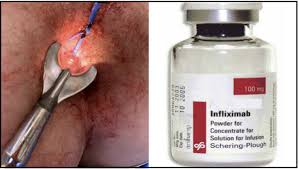 Image result for Infliximab