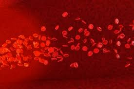 In sickle cell disease, the hemoglobin is abnormal, causing the red blood cells to be rigid and shaped like a c or sickle, the shape from which the disease takes its name. Sichelzellenanamie Deximed