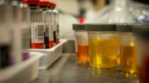 Quest Diagnostics West Chester Premier Infosource Drug Testing