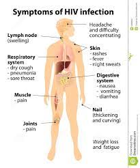 Symptome Der Hiv Infektion Vektor Abbildung Illustration Von Viren 53882847