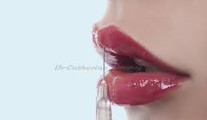 Les rouges à lèvres à l'acide hyaluronique constituent la solution beauté la plus simple pour repulper sa bouche naturellement. Le Repulpage Et L Embellissement Des Levres Avec L Acide Hyaluronique