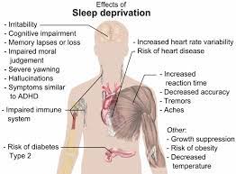 Sleep Deprivation Leads To Symptoms Of Schizophrenia Neuroscience News