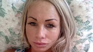 Het lijkt erop dat samantha de jong, beter bekend als barbie uit oh oh cherso, toch niet in het huwelijksbootje stapt met gerrit meerts. Barbie Zonder Botox Kan Een Gezicht Nog Herstellen Rtl Nieuws